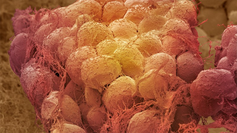 A scanning electron microscope image shows a close up of fat tissue in false color. The cells are rounded with strings of connective tissue attached.